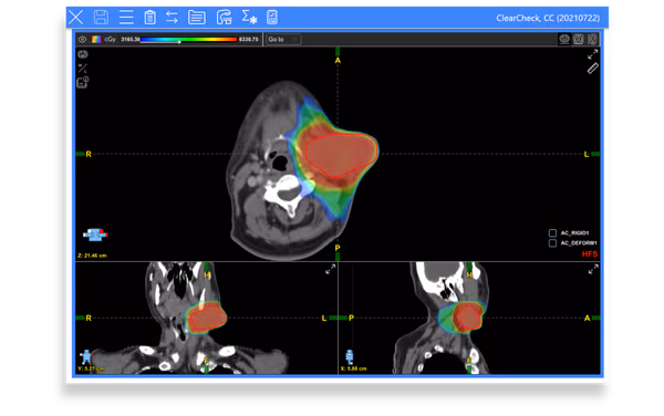 Deformed Dose Analysis
