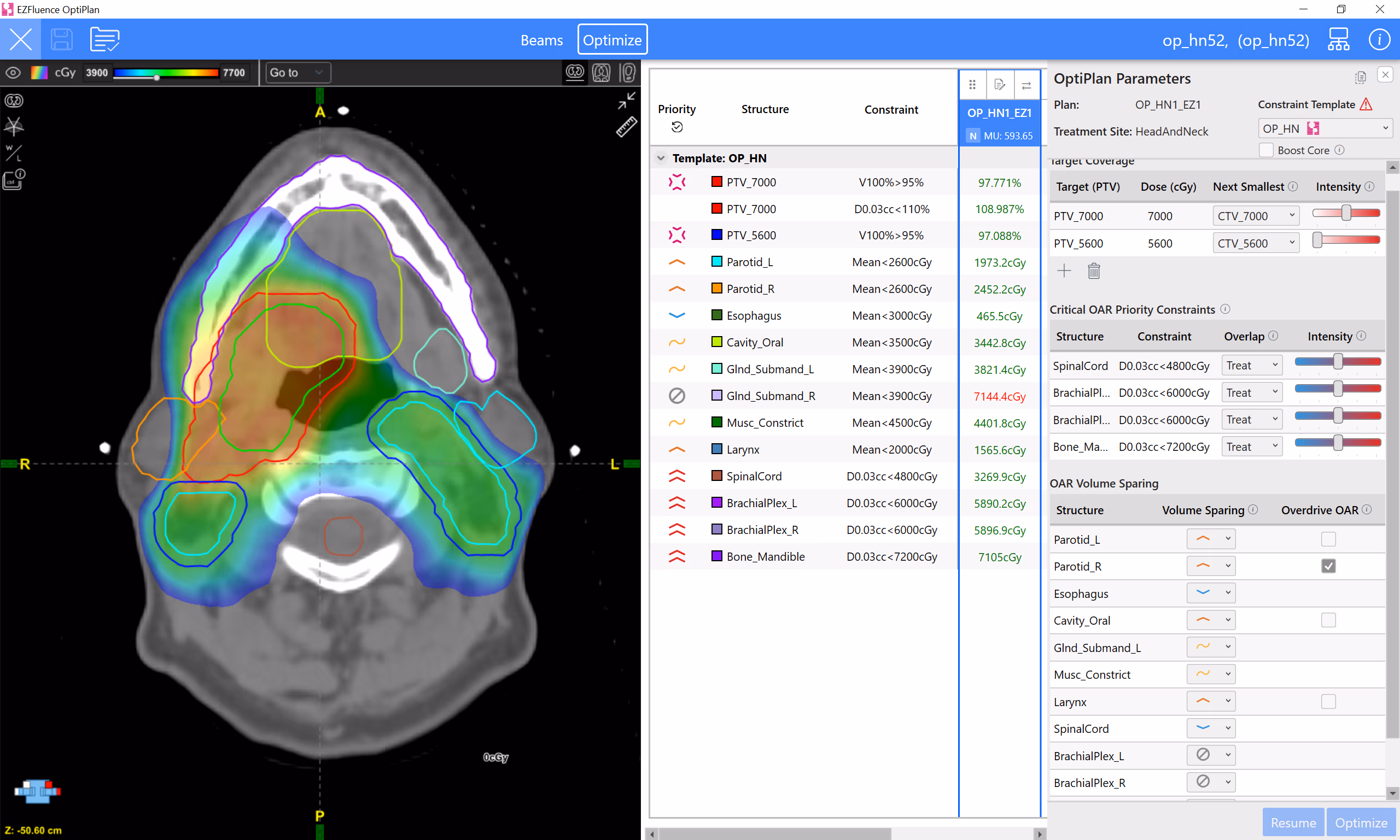 OptiPlan