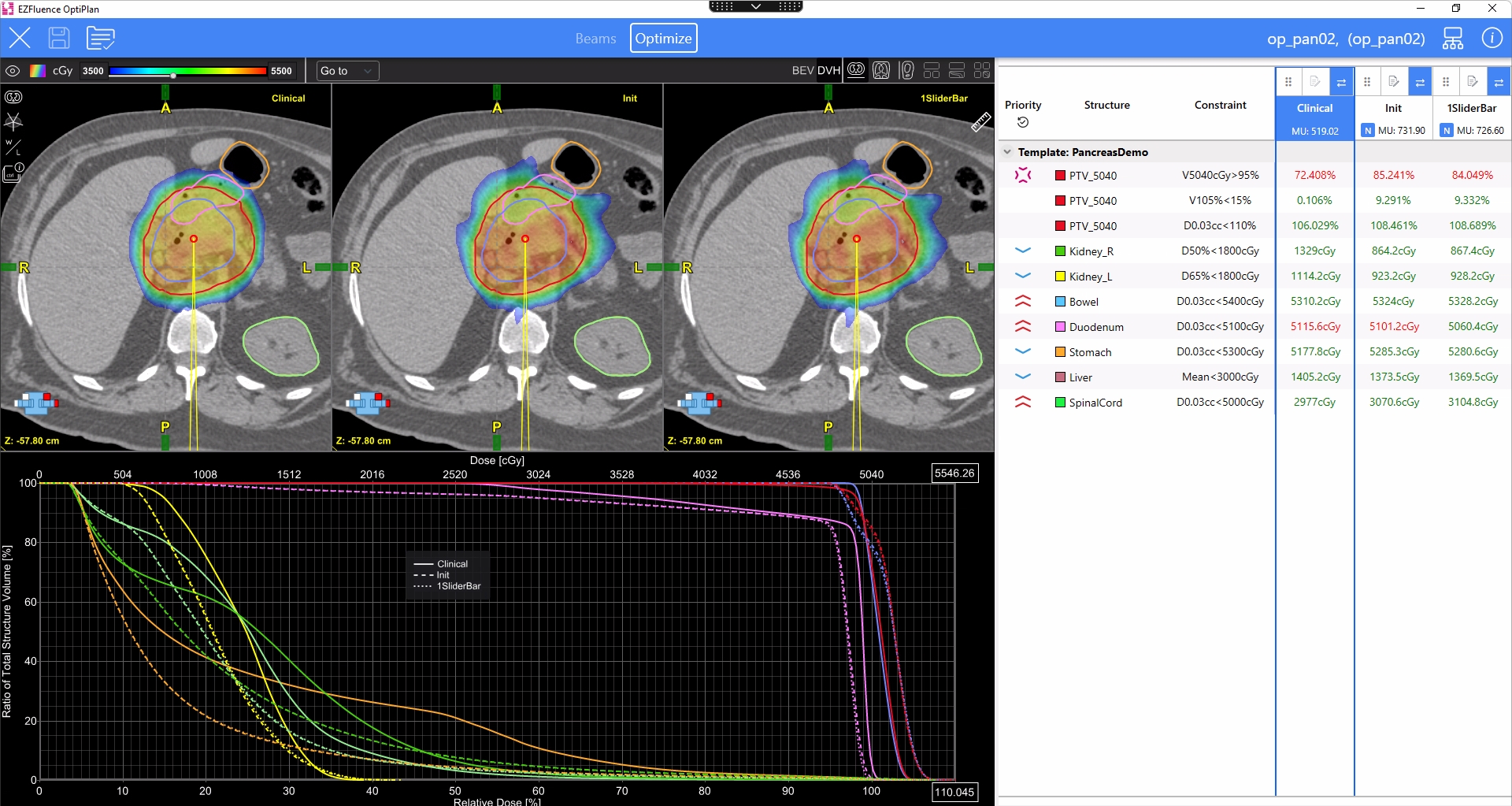 Pancreas plan comparison in OptiPlan