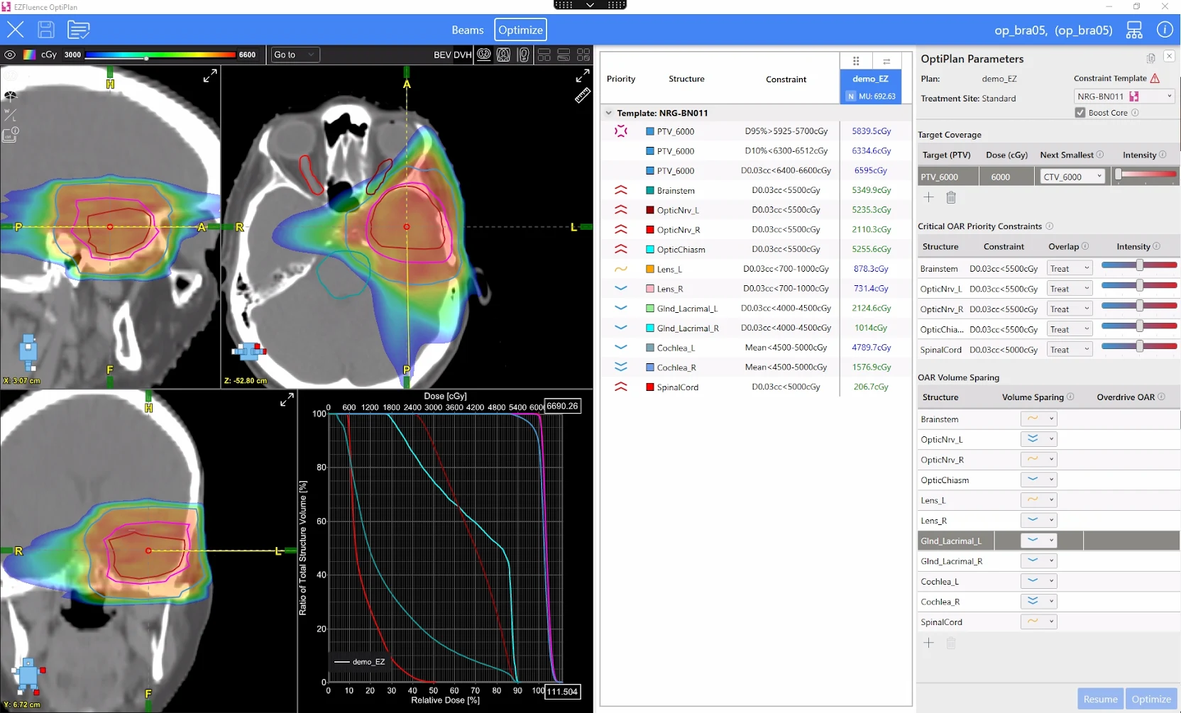 Brain plan optimization in OptiPlan